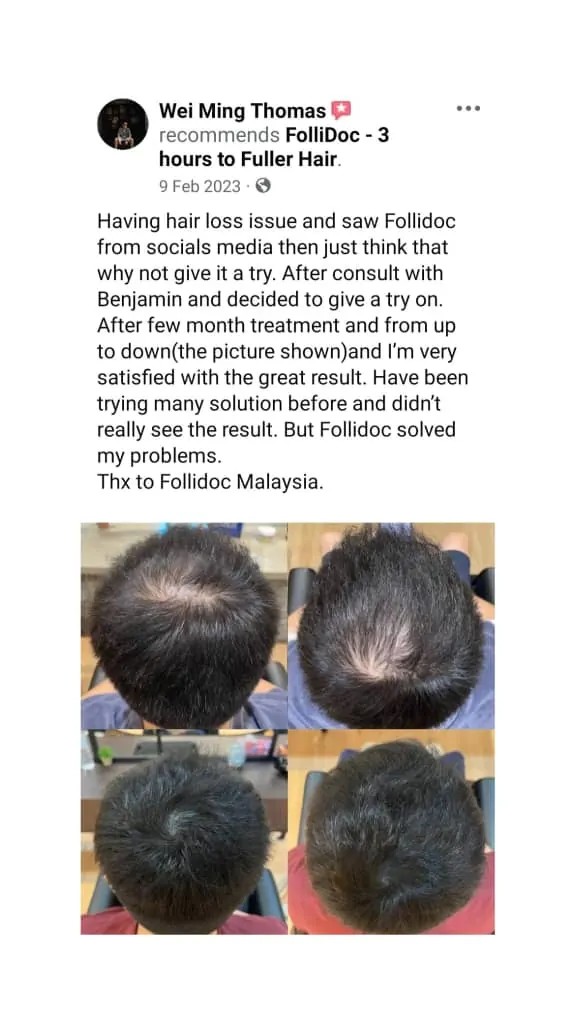 Five-star Google review of Folli-Doc
