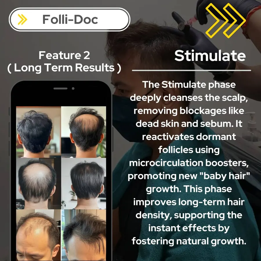 Feature 2: Stimulate, long-term results